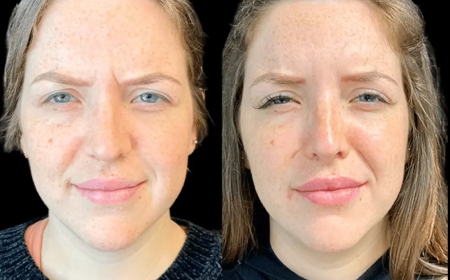 Best Aesthetic Clinic in Dubai for Men: Tailored Treatments for Every Client