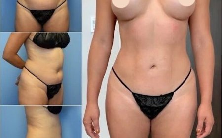 Why Choose the Best Body Contouring Surgeon in dubai for Your Body Transformation?