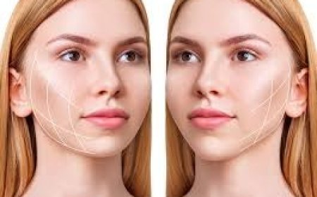 Rejuvenating the Face with SMAS Lifting: A Modern Approach to Lasting Facial Rejuvenation