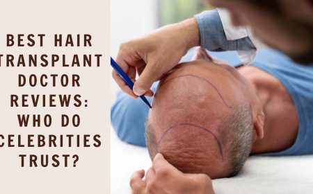Best Hair Transplant Doctor Reviews: Who Do Celebrities Trust?