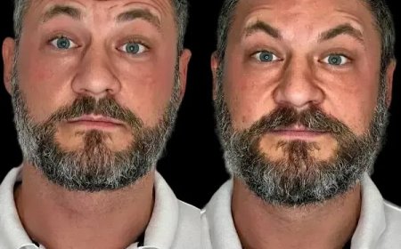 Craft Youthful Skin with Profhilo by Best Plastic Surgeons in dubai