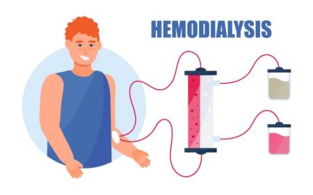 Top Benefits of Doing Hemodialysis in Your Own Space