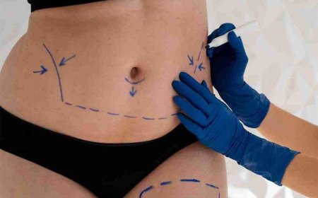 Is Liposuction In Dubai Effective for Long-Term Results?