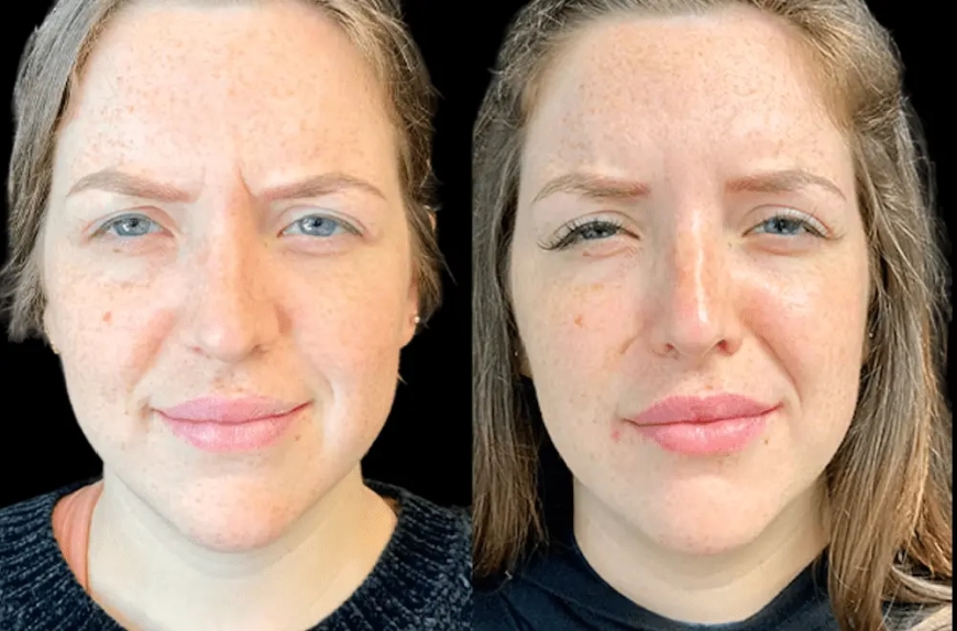 Best Aesthetic Clinic in Dubai for Men: Tailored Treatments for Every Client