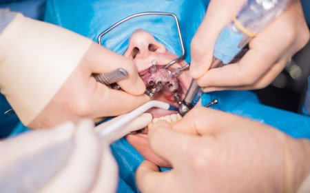 Children’s Oral Surgery: Finding a Pediatric Oral and Maxillofacial Surgeon in Dubai