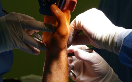 Recovering from Surgery: Tips from a Leading ortho doctor in dubai