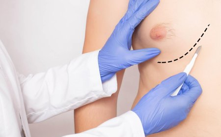 Managing Scars After Male Breast Reduction in Islamabad