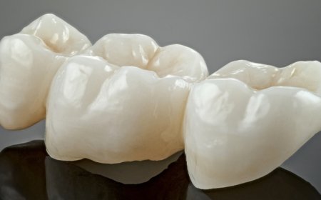 How Many Times Can a Crown Be Replaced?