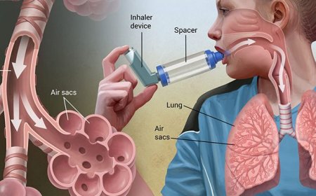 Top Lung Specialist Pune | Expert Pulmonology Services Near You